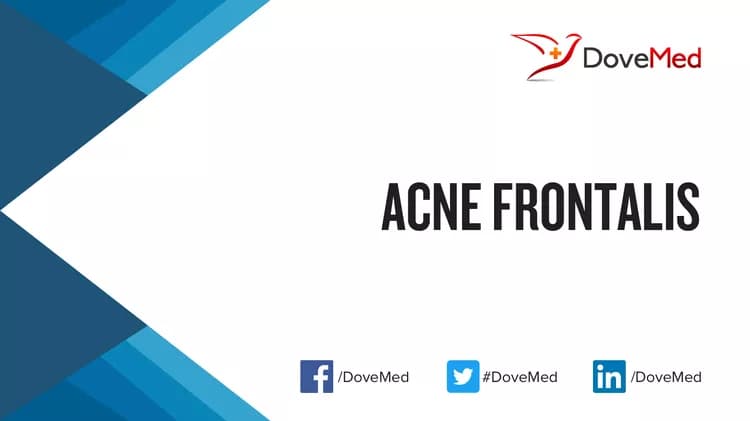 Acne Frontalis