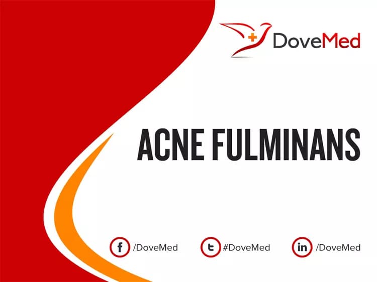 Acne Fulminans