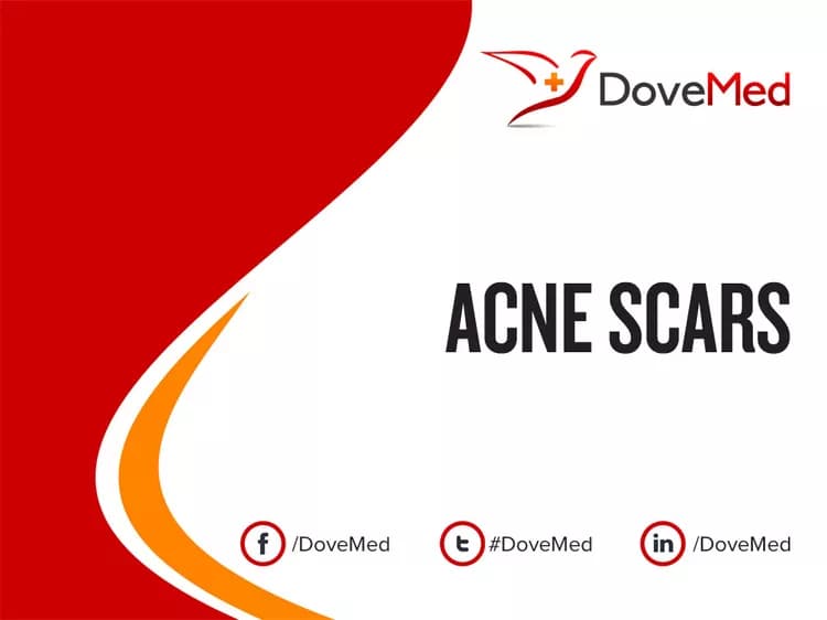 Acne Scars