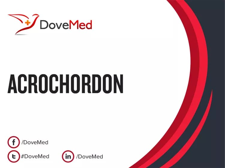 Acrochordon