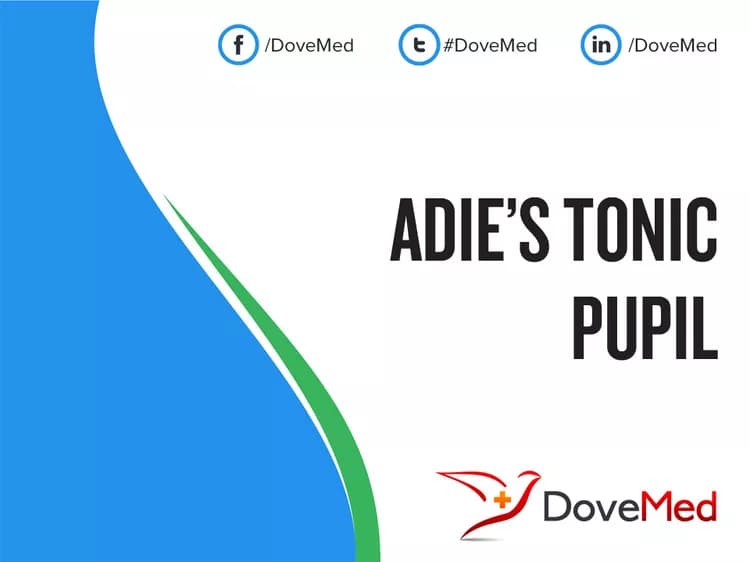 Adie’s Tonic Pupil
