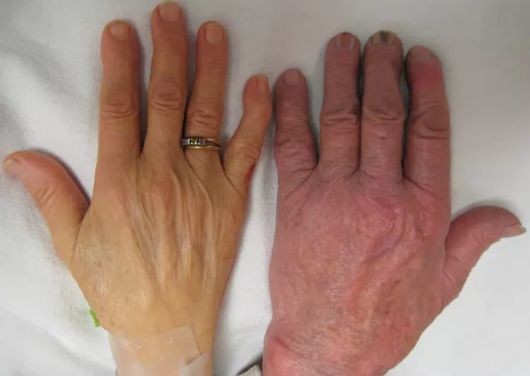 James Heilman, MD