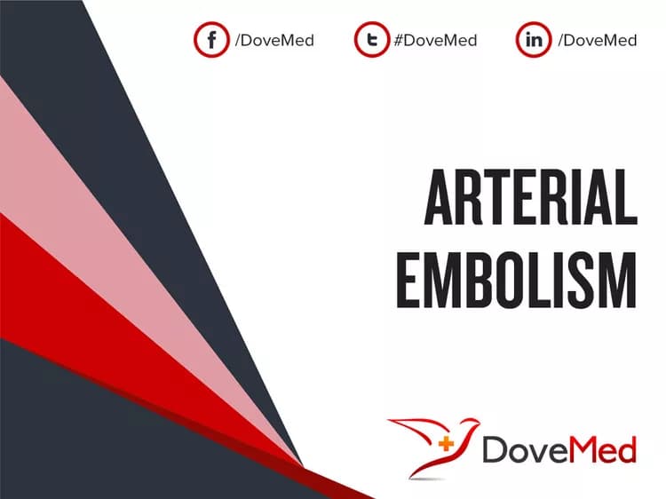 Arterial Embolism