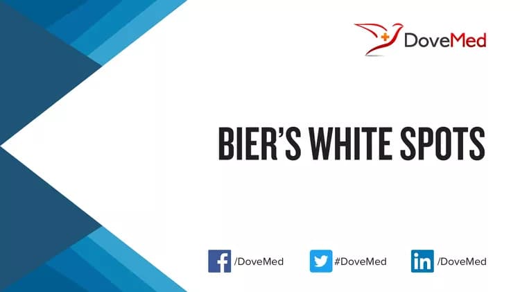 Bier’s White Spots