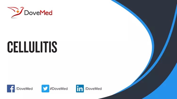 Cellulitis