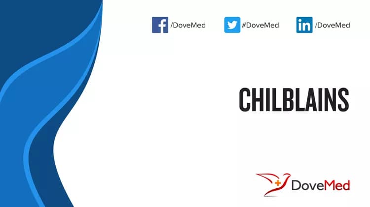 Chilblains