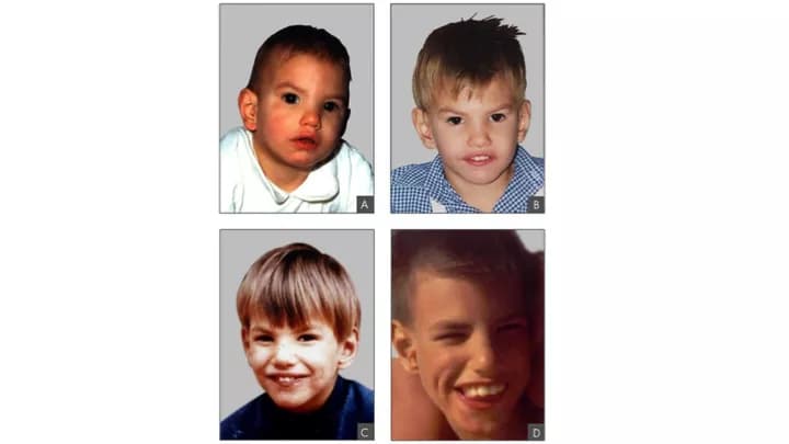 Filip em
