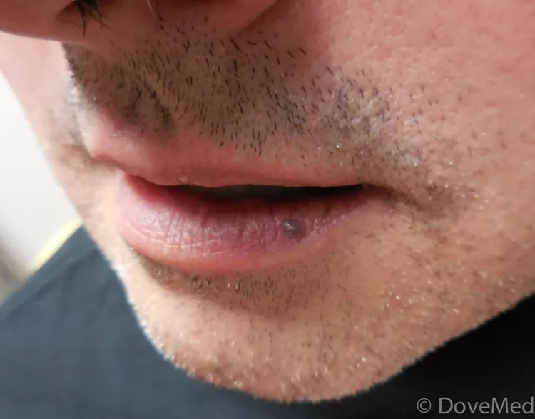 DoveMed.com