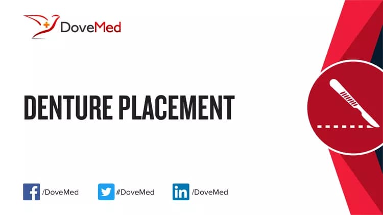 Denture Placement
