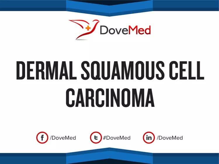 Dermal Squamous Cell Carcinoma