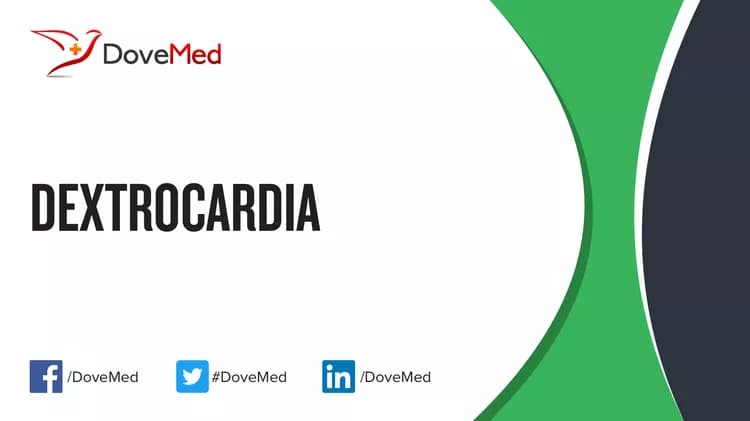 Dextrocardia