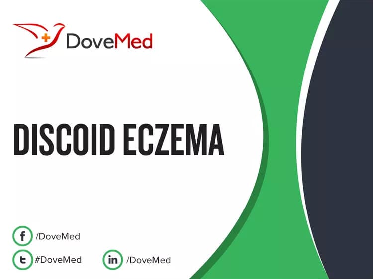 Discoid Eczema