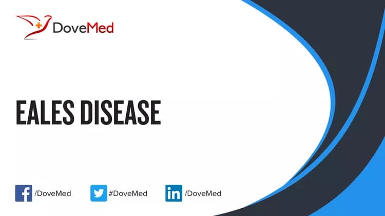 Eales Disease