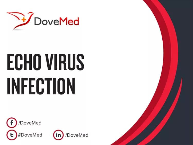 Is the cost to manage Echo Virus Infection in your community affordable?