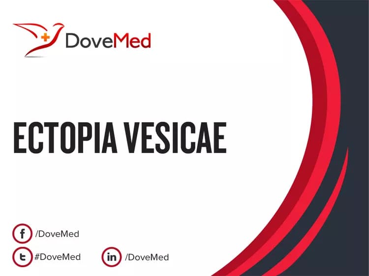 Ectopia Vesicae