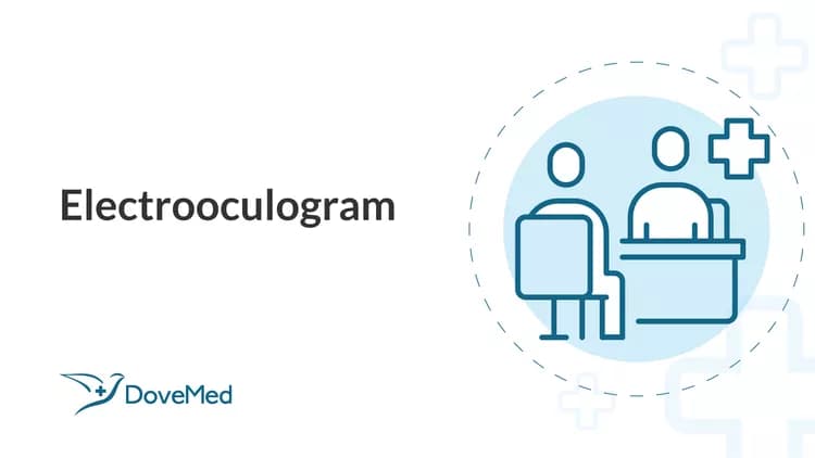 Electrooculogram