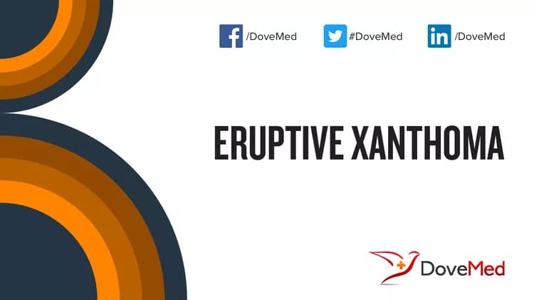 Can you access healthcare professionals in your community to manage Eruptive Xanthoma?