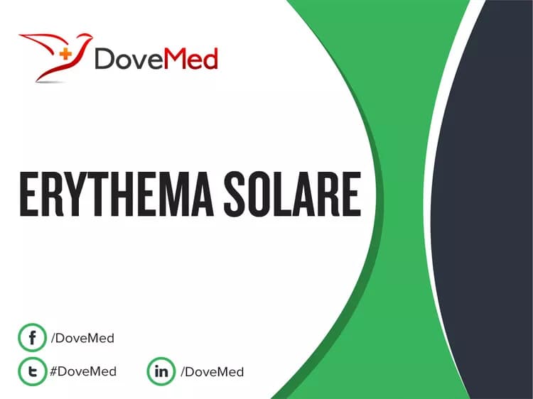 Erythema Solare