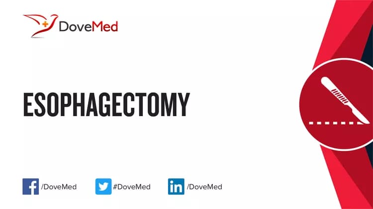 Esophagectomy