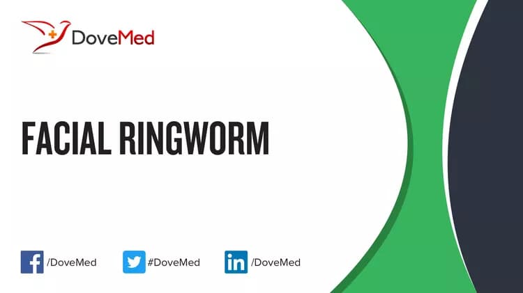Facial Ringworm