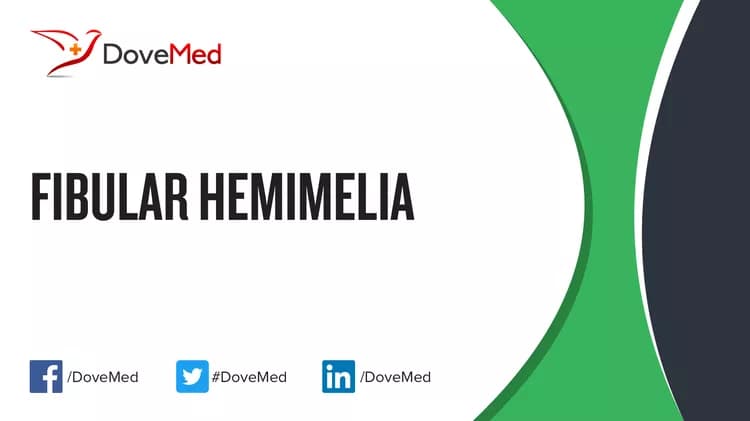 Fibular Hemimelia