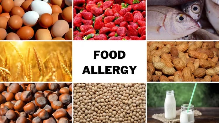 Food Allergy
