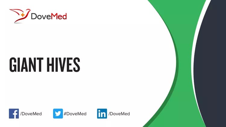 Giant Hives