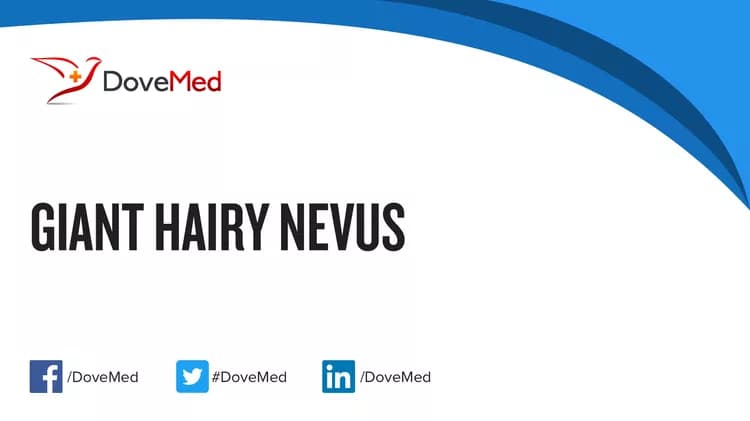 Giant Hairy Nevus