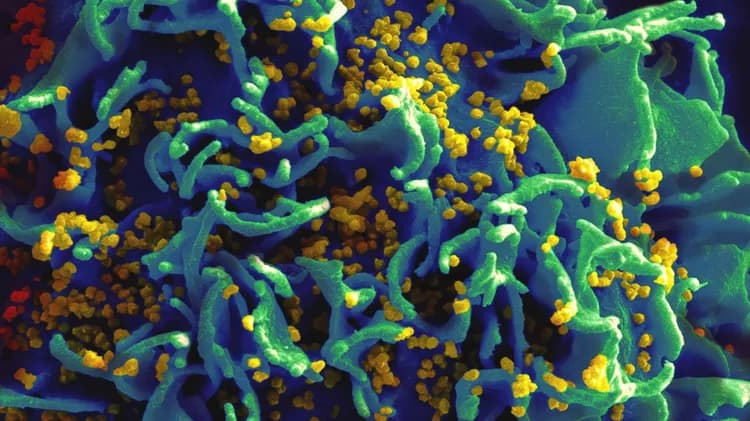 National Institutes of Health (NIH)