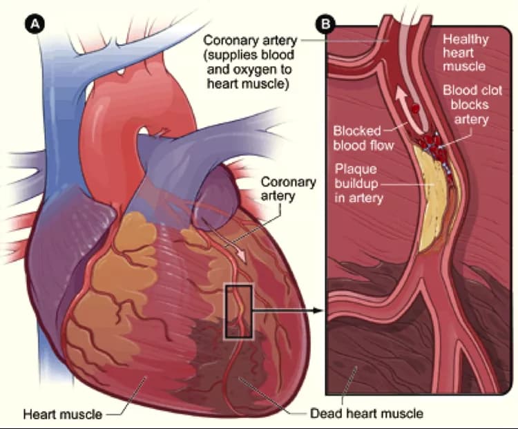 National Heart, Lung and Blood Institute
