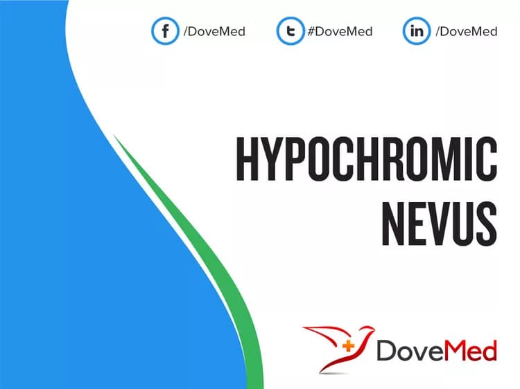 Hypochromic Nevus