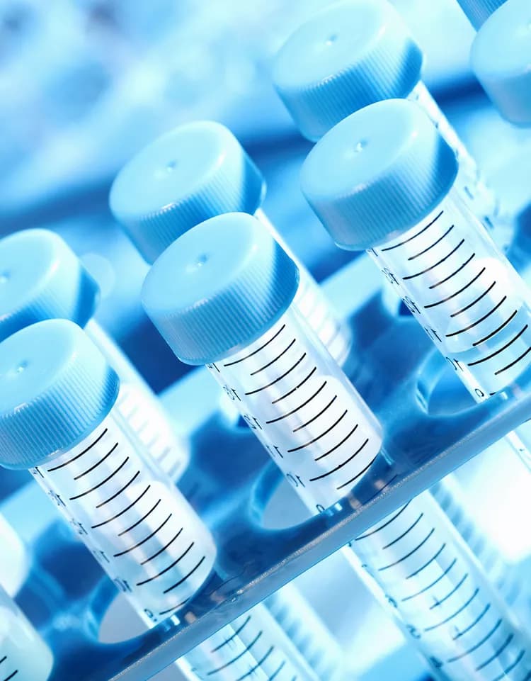 Antiglomerular Basement Membrane Antibody Blood Test