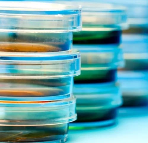 Bacterial Wound Culture