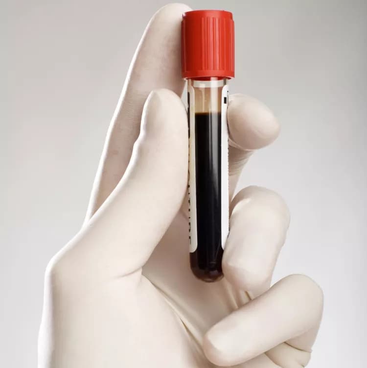 Reprogrammed Blood Vessels Promote Cancer Spread