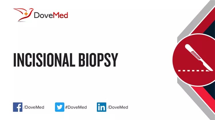 Incisional Biopsy