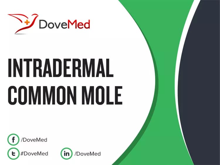 Intradermal Common Mole