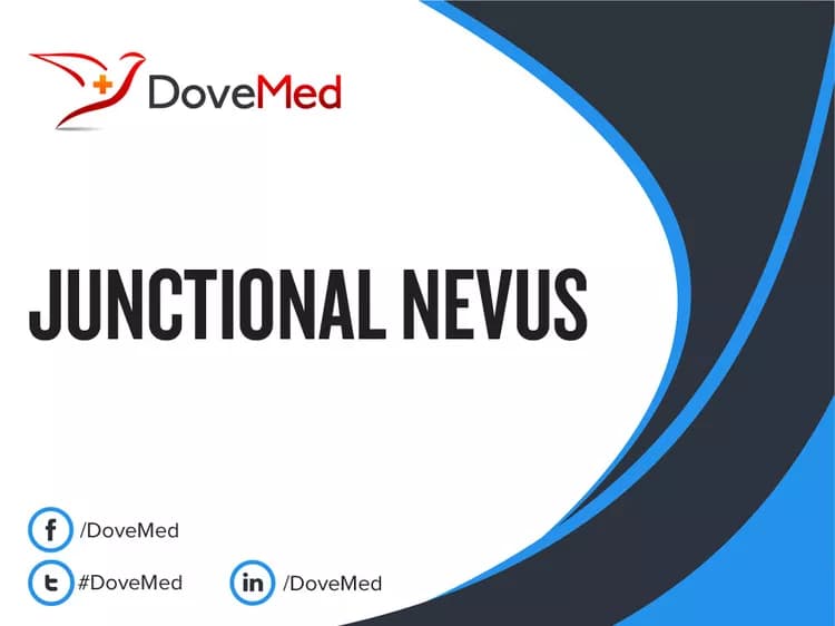 Junctional Nevus