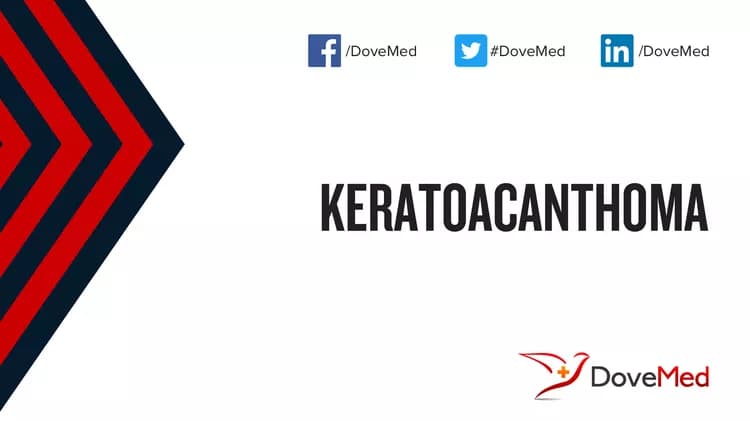 Keratoacanthoma
