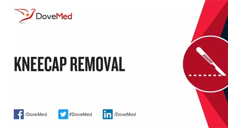 Kneecap Removal