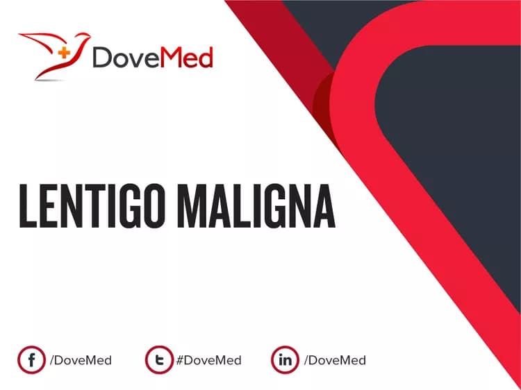 Lentigo Maligna