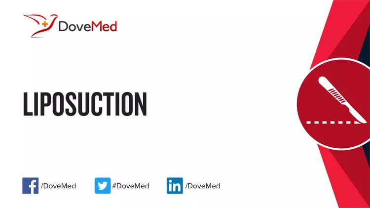Liposuction