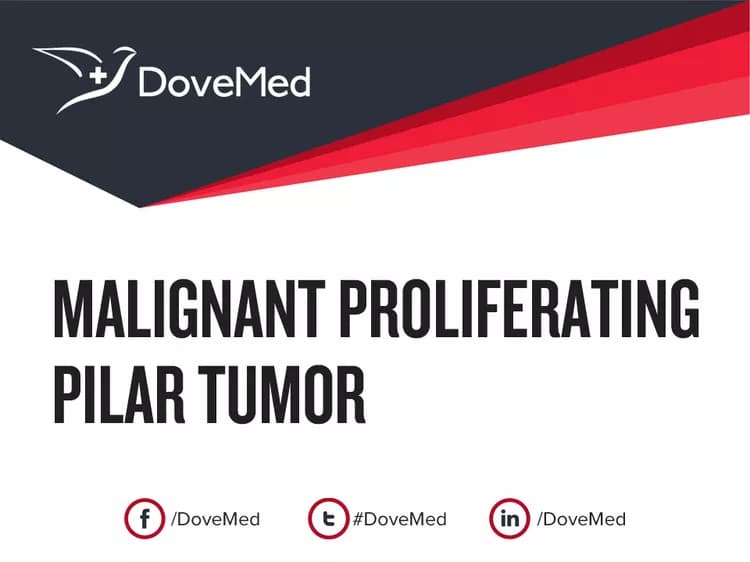 Is the cost to manage Malignant Proliferating Pilar Tumor in your community affordable?