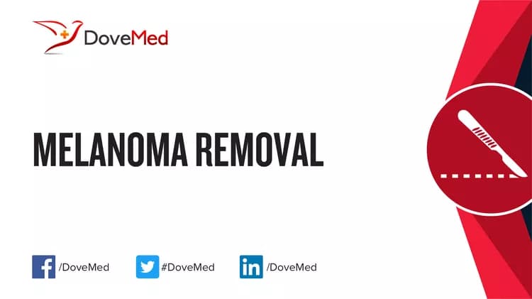 Melanoma Removal