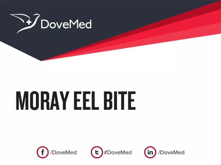 Is the cost to manage Moray Eel Bite in your community affordable?