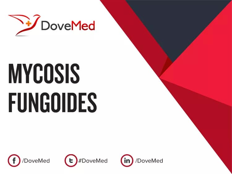 Mycosis Fungoides