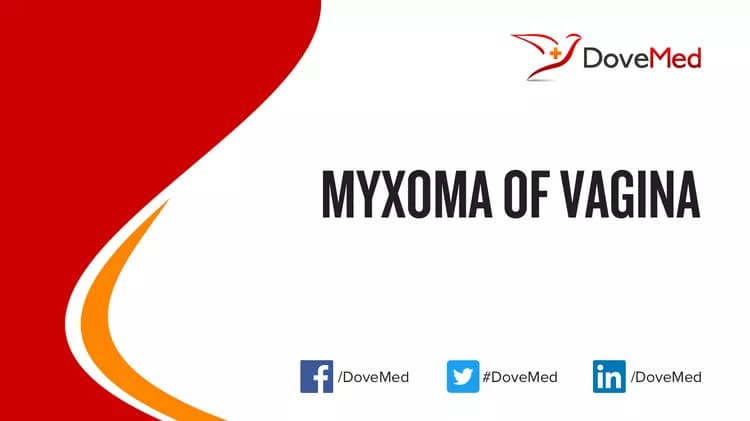Myxoma of Vagina