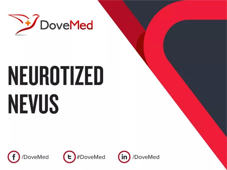 Are you satisfied with the quality of care to manage Neurotized Nevus in your community?