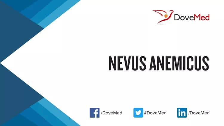 Nevus Anemicus