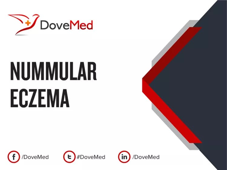 Nummular Eczema