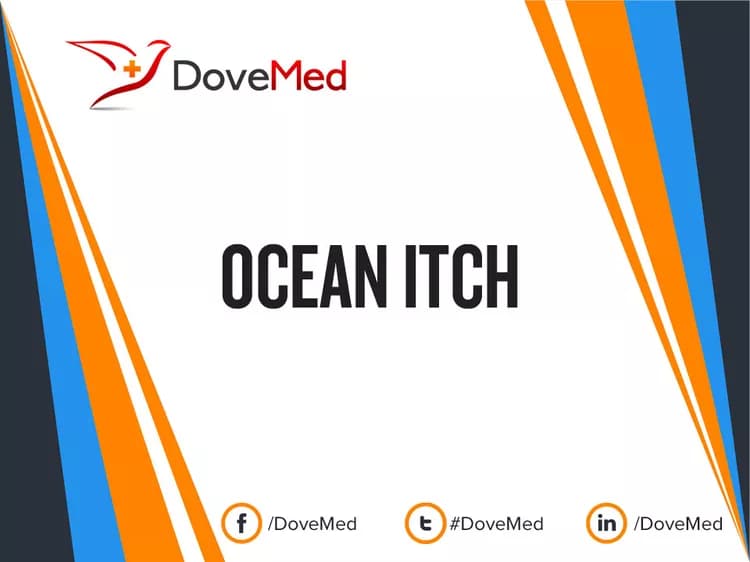 Ocean Itch